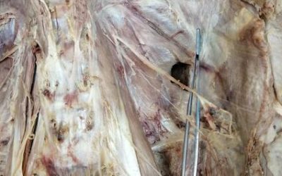 A message on the Psoas